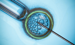 泰国试管婴儿流程时间安排